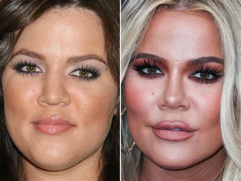 Khloe Kardashian finally admits to plastic surgery: .